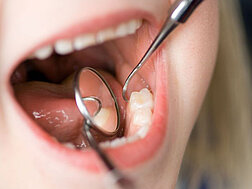 Nahaufnahme einer regulären Zahnuntersuchung bei einem Kind